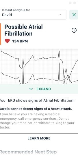Kardia